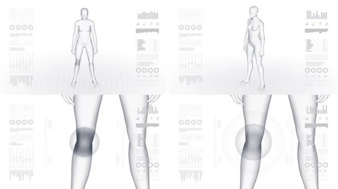 膝盖病变的女孩。女性的3d身体。女性人体结构的旋转动画和特写。4k镜头。