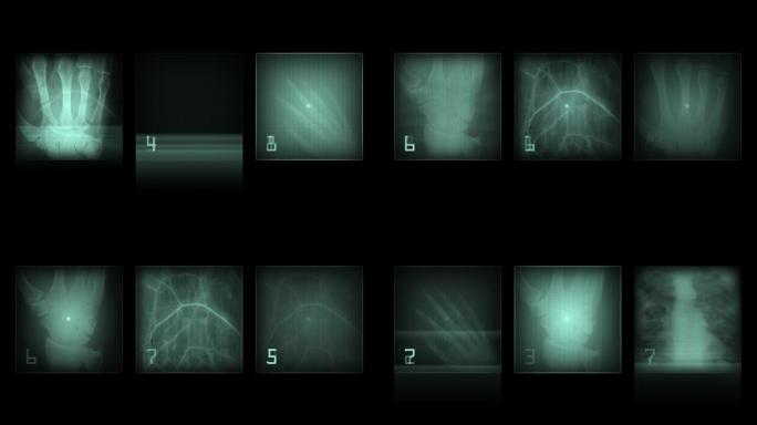 动画-黑色背景上的x射线面板