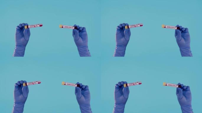 男性手与蓝色手术乳胶手套持有阳性新型冠状病毒肺炎和SARS-CoV-2血液试管隔离在蓝色背景
