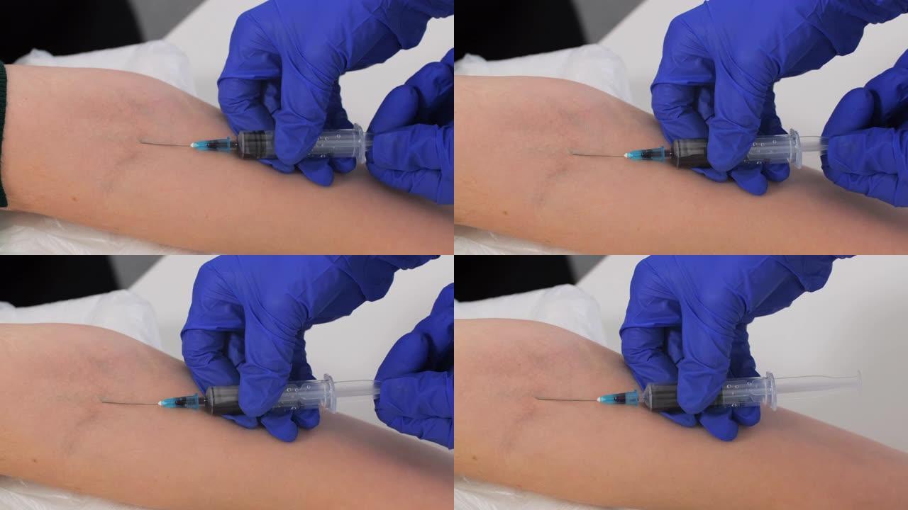 静脉采血的特写。医生的手在蓝色无菌手套收集血液到注射器从病人的静脉。冠状病毒扫描。健康概念和测试