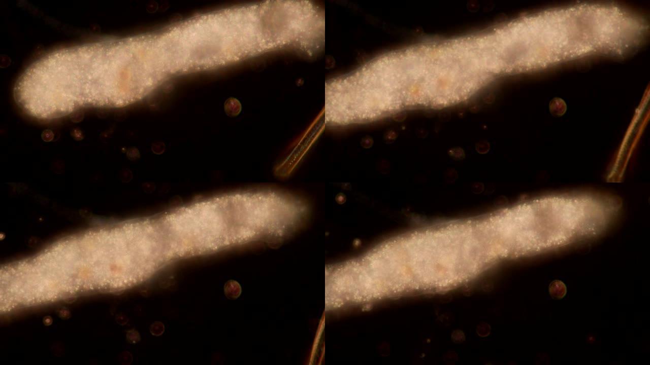 阿米巴通过使用伪足来移动和觅食，伪足是由肌动蛋白微丝的协调作用所形成的细胞质凸起，将围绕细胞的质膜推