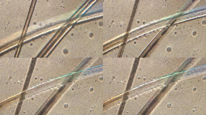 人类头发 (睫毛和眉毛) 的显微镜检查。显微镜下详细放大150x根和毛柄。