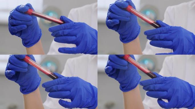 用冠状病毒验血的双手合起来。一名医生戴着防护手套，两只手在实验室里从一侧倾斜到另一侧的血管。流行病、