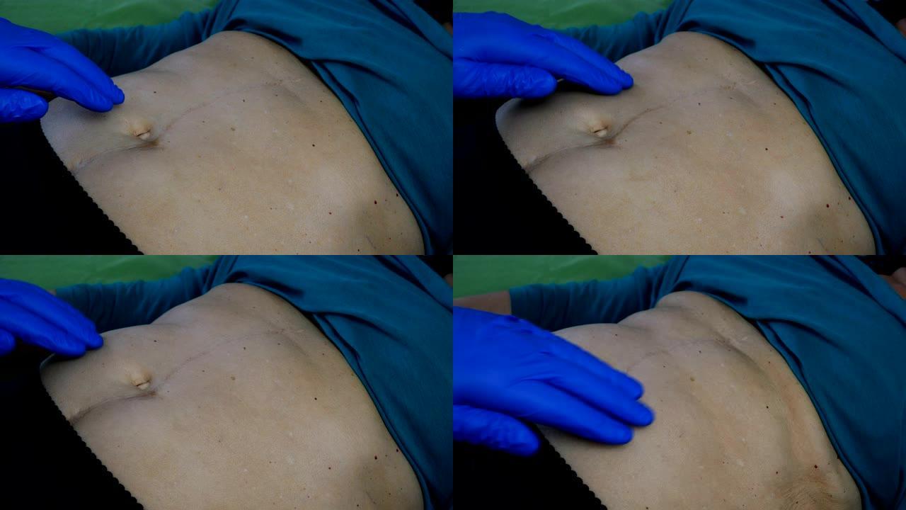 医生用手在生病的女人的蓝色橡胶手套肚子里触诊。