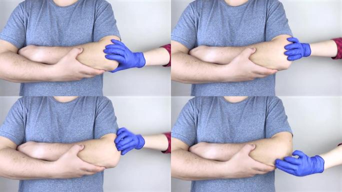 一个男人患有肘部疼痛。肘关节受损，骨折或扭伤。手部损伤和屈曲疼痛概念