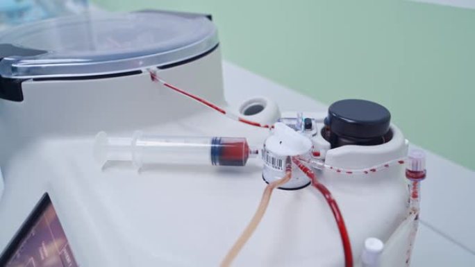 干细胞注射程序输血特写视频素材