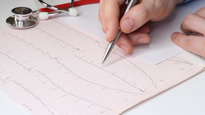 心脏病专家查看心电图并向药房开具处方。Fennedoscope，听诊器和心电图。医疗保健和早期诊断概