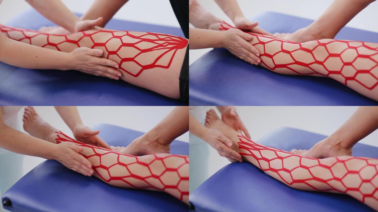用kinesio胶带粘贴的病人腿的特写镜头。疼痛治疗。运动和康复。女性腿上有运动学胶带