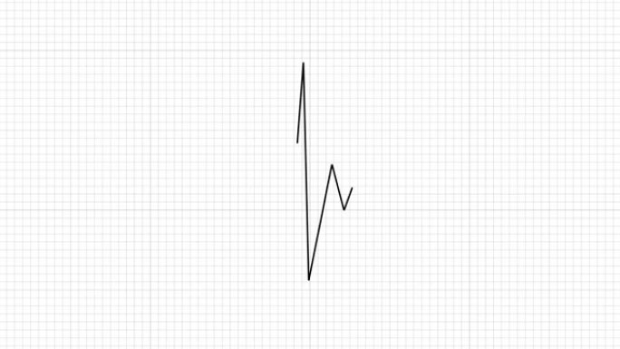 心跳线和EKG心电图4k可循环