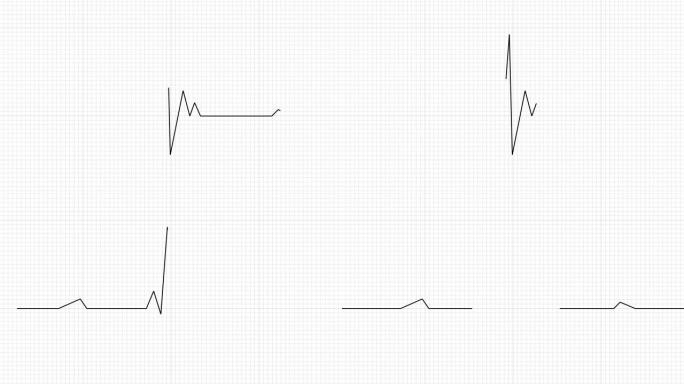 心跳线和EKG心电图4k可循环