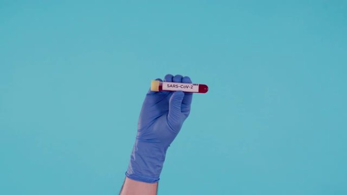 男性手与蓝色手术乳胶手套持有SARS-CoV-2血液试管隔离在蓝色背景