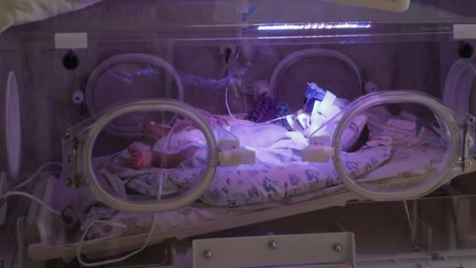新生儿躺在医院婴儿床里的侧视图。婴儿在保育箱在医生的监督下。重症监护病房