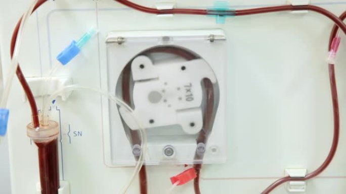 现代透析机在透析部门进行血液净化。