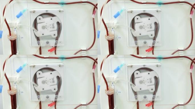现代透析机在透析部门进行血液净化。