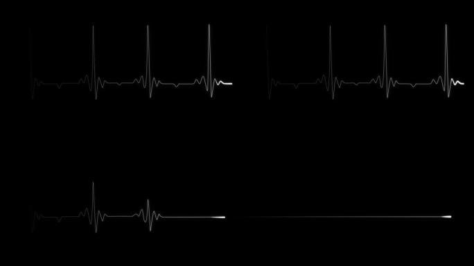 脉冲线心跳。心脏骤停。逼真的动画心律心电图