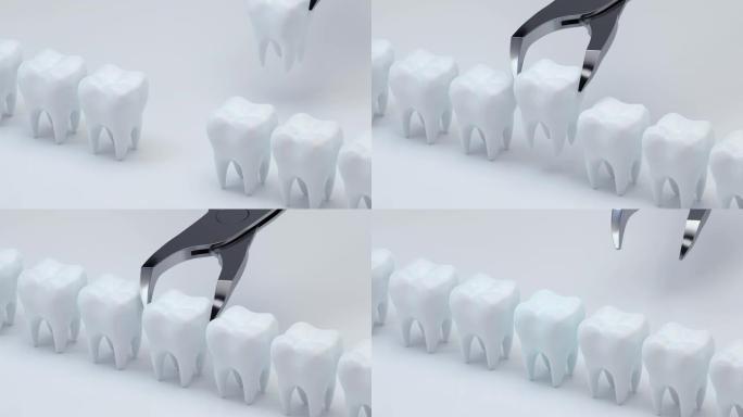 安装新牙齿的动画，3d渲染。
