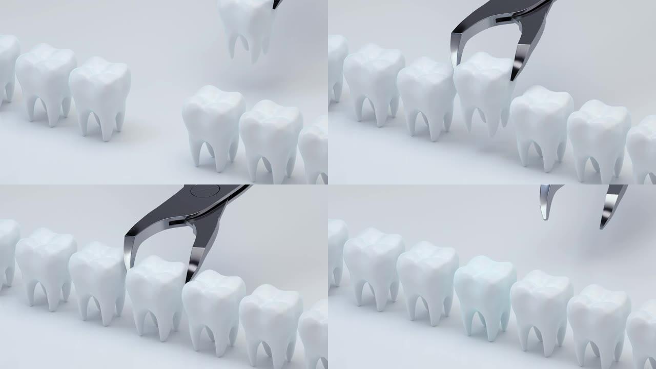 安装新牙齿的动画，3d渲染。