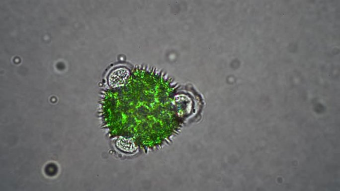 显微镜下冠状病毒的绿色细胞是foalfoot的花粉细胞