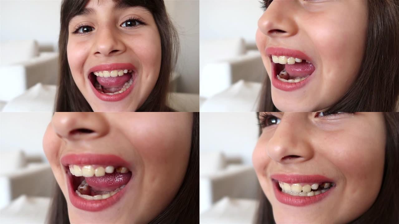 女孩牙齿有龋齿