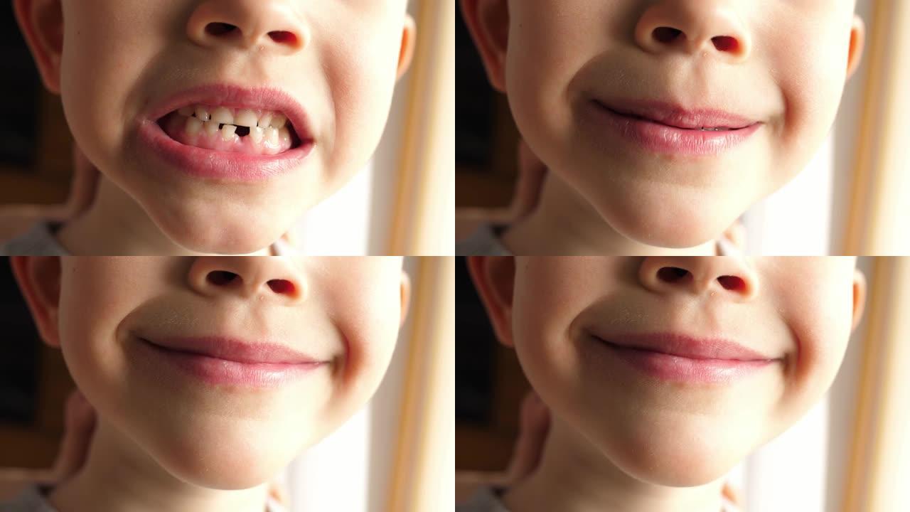 男孩从乳牙上掉下来后微笑并显示出洞