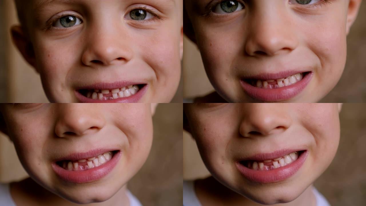 快乐英俊男孩的特写，展示他不断变化的牙齿。