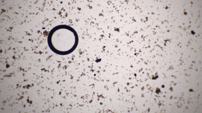 显微镜上看到的沉淀的脏水。详细视频