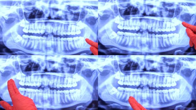 女牙医在监视器上显示病人的健康牙齿