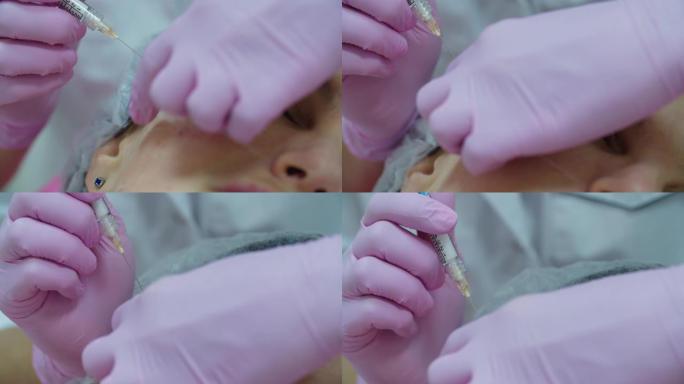 美容师用注射器将粉红色的手套交给成年女性注射抗衰老的面部填充物，宏观视图。美容注射程序。