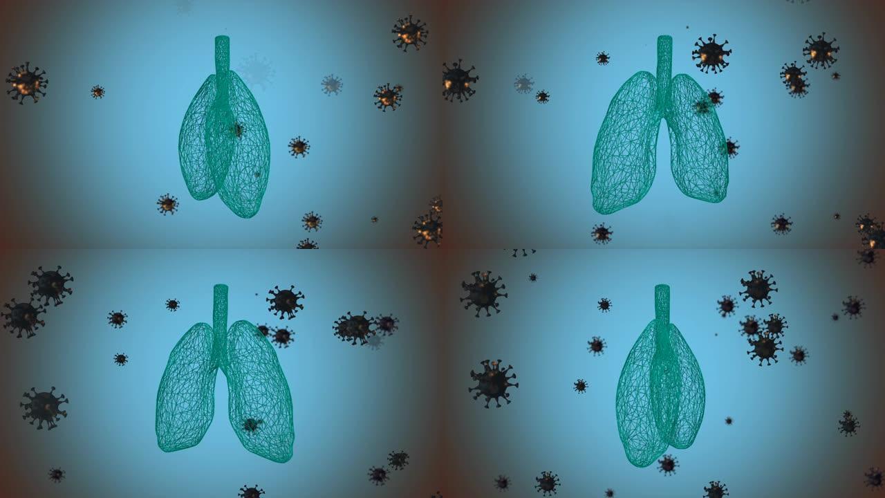 人类肺部的动画因肺炎或电晕病毒等疾病而发炎和感染。