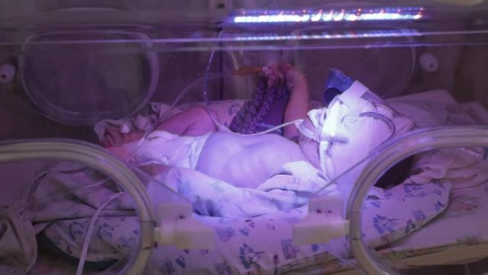 婴儿躺在培养箱中，与用于营养的管子相连。宝宝动腿，侧视重症监护，新生儿在医生监护下