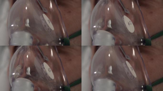 一名戴着氧气面罩的男性在医院拍摄的特写镜头