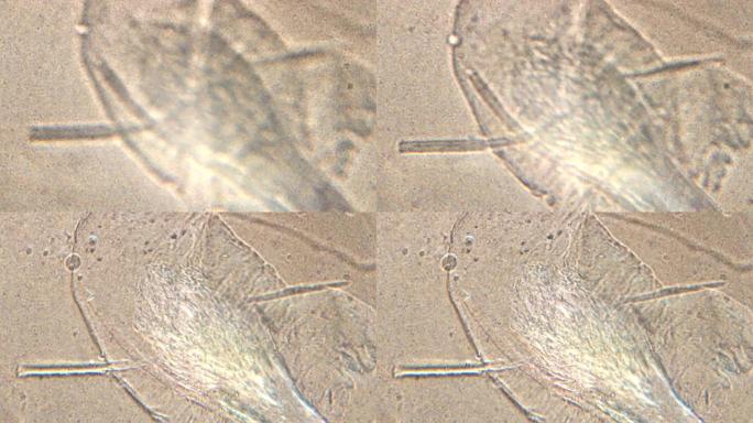 人类头发 (睫毛和眉毛) 的显微镜检查。显微镜下详细放大150x根和毛柄。