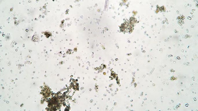 细菌和纤毛虫Colpoda在显微镜下从泰国沼泽进入水中