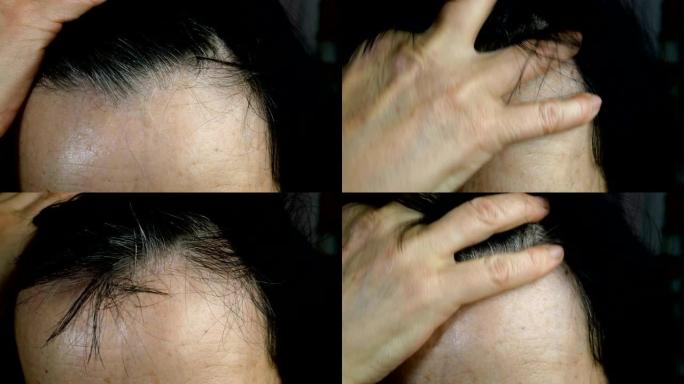 成熟的成年女性去除额头上的头发。