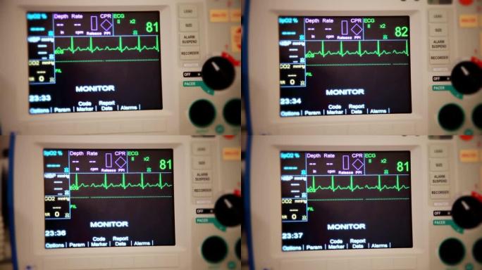 从患者的角度看心脏监护仪的逼真镜头显示正常的窦性心律