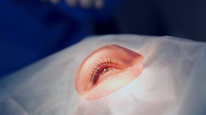 患者眼部治疗患者眼部治疗手术近视白内青光