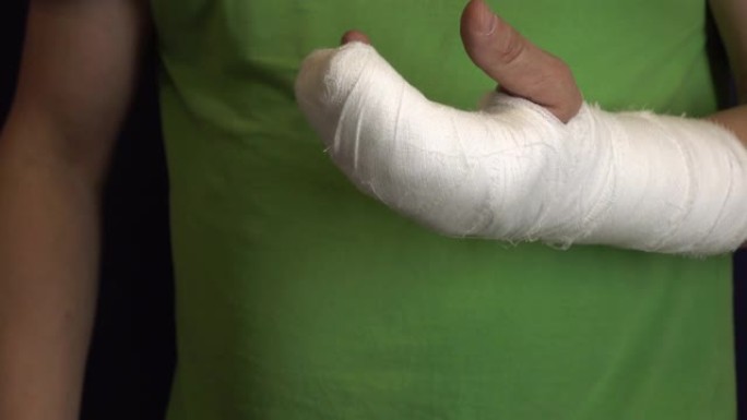 一个男人在石膏中抓伤了他的手臂。