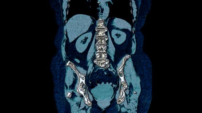 腹腔，胃肠道，膀胱的整体彩色MRI