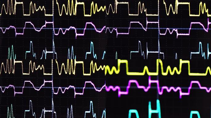 频率特写镜头医疗行业波形分析