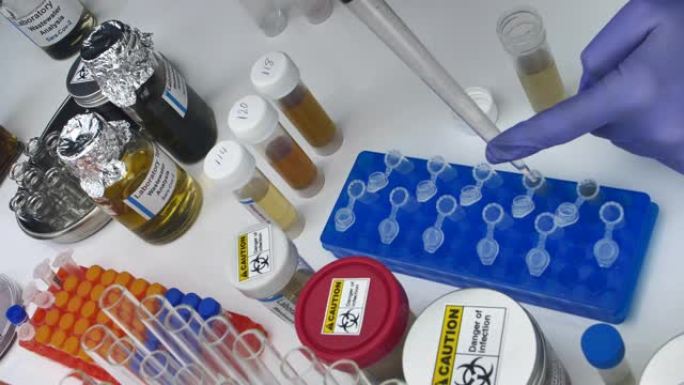 实验室废水样品的科学分析，人体Sars-Cov-2可能污染的调查