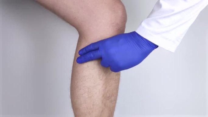 一个男人的小腿疼痛。伸展小腿肌肉，静脉曲张，腿抽筋或肌炎。骨科医生检查
