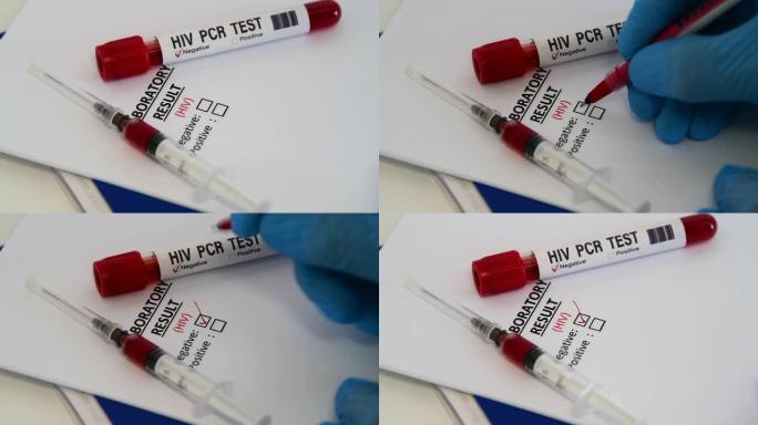 HIV病毒检测。艾滋病血液测试