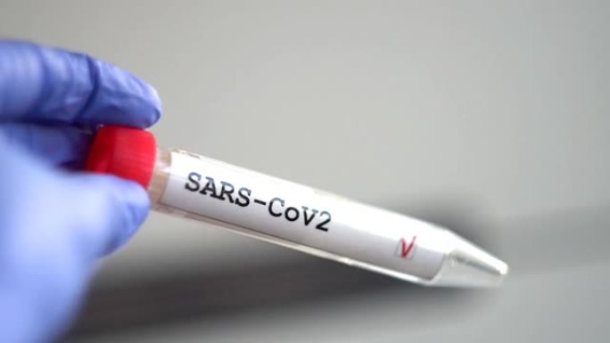 冠状病毒测试。新型冠状病毒肺炎测试或SARS-CoV-2测试。停止传播