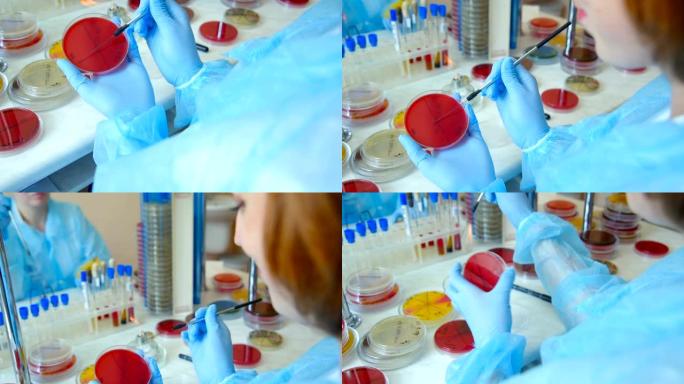 细菌实验室中培养皿中微生物和病原真菌的菌落