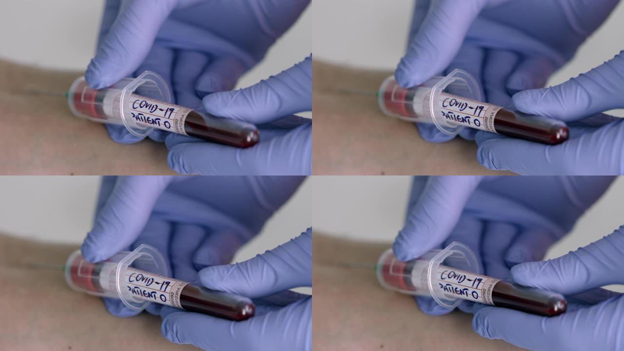 慢速Mo: 护士从可疑新型冠状病毒肺炎患者零采集血液样本-第3部分