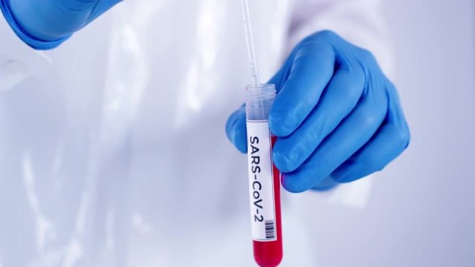 医疗实验室工作人员，戴着蓝色手术手套，拿着血液样本管，抽取血液用于测试冠状病毒新型冠状病毒肺炎 (2