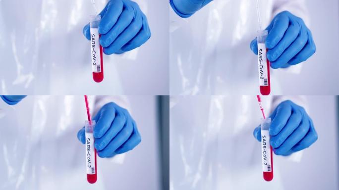 医疗实验室工作人员，戴着蓝色手术手套，拿着血液样本管，抽取血液用于测试冠状病毒新型冠状病毒肺炎 (2