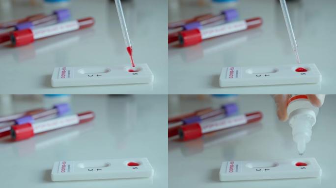 戴着手套的医生做病毒性疾病的快速测试在实验室卡套件测试中滴血