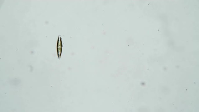 在显微镜下在白色背景上分离出的蓝藻藻cymbella