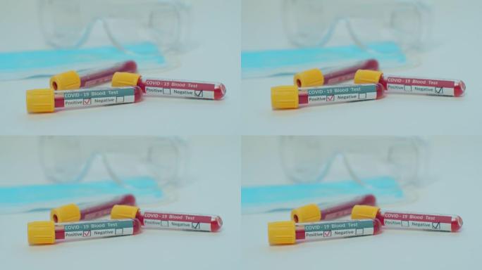 医学生物技术实验室冠状病毒新型冠状病毒肺炎试管的实验测试。